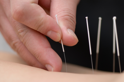 When is Acupuncture Appropriate for Infertility?